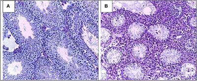 Pathomechanisms of Autoimmune Based Testicular Inflammation